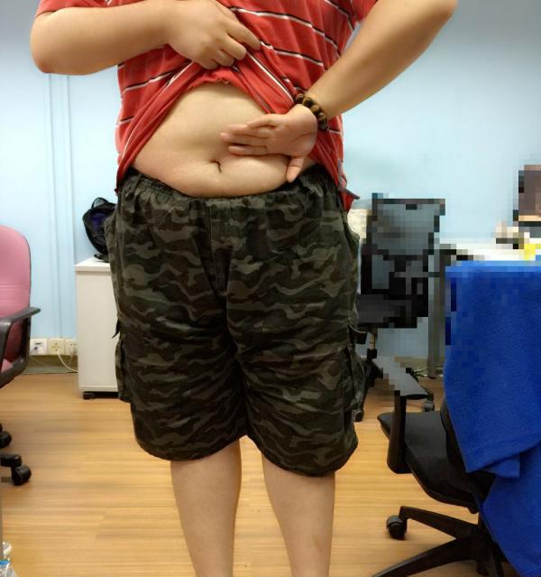 專家稱操作不當容易導(dǎo)致肩膀脫臼