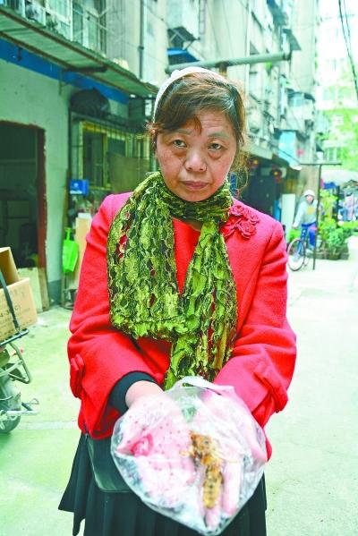 頭部受傷的黃女士展示兩根大魚(yú)刺。