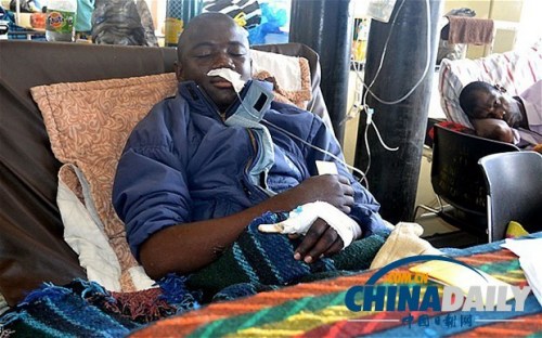 雖然已經(jīng)在醫(yī)院接受了近一個月的恢復治療，卡托卡的身體仍然非常虛弱。