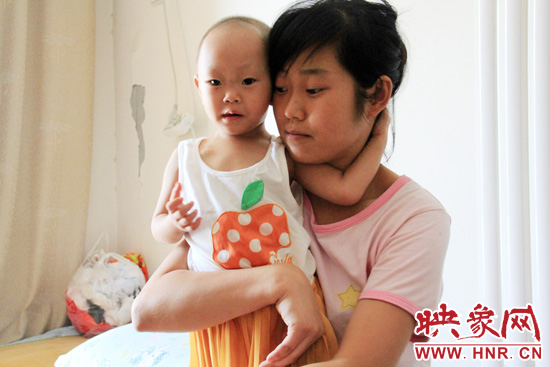 孩子和媽媽在一起，她的右眼已經(jīng)失明。