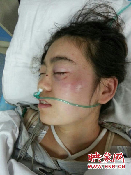 9月10日晚,被暴打的小陳出現(xiàn)了間歇性昏迷,被送進(jìn)了省人民醫(yī)院。