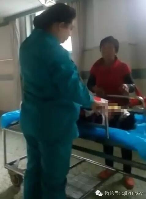 涵涵爸爸告訴《每日新聞》記者：“沒想到是熱水，大人也沒看，一時疏忽，掉進去了。抱出來的時候這個皮已經掉了。”