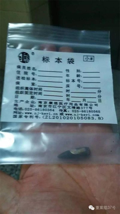 經(jīng)警方鑒定，秦女士體內(nèi)取出的子彈系56式步槍射出 。 受訪者供圖
