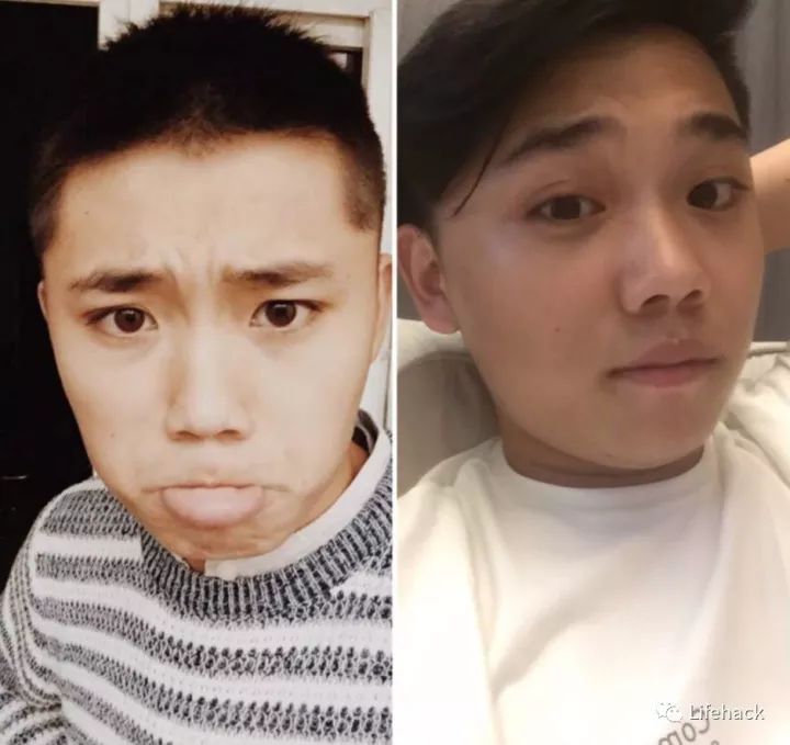 長胖20斤，臉型怎么變？這些例子看完扎心了！