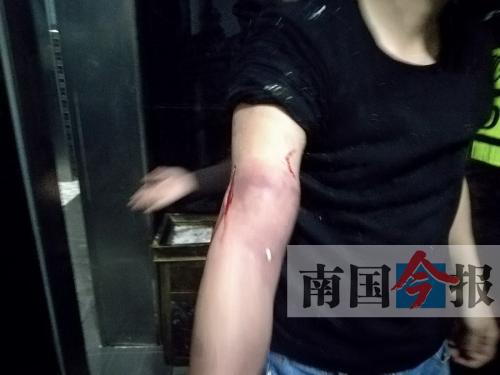 覃先生手臂被卡的部位受傷流血，所幸傷勢無大礙。 通訊員 王建民 攝
