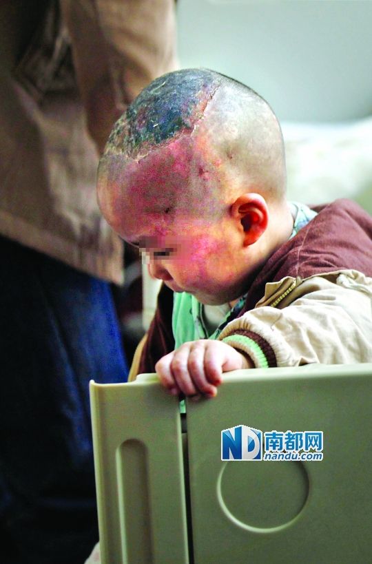 1月8日下午，小寶頭上和臉上都是傷痕。