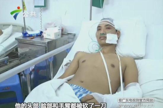 另一名傷者頭部、臉部和手臂都被砍了一刀。(視頻截圖)