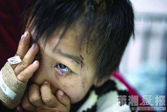 1月13日，湖南省兒童醫(yī)院，4歲的源源用手蒙住了眼睛。