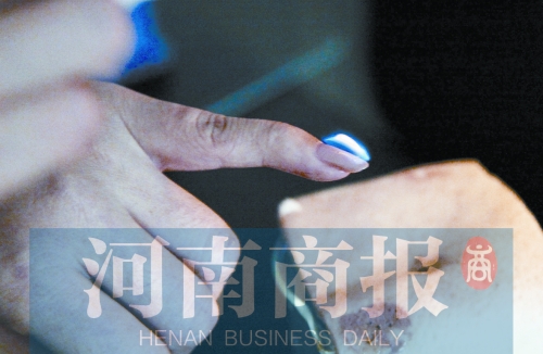 將指甲油涂在指甲上，靠近火焰時被引燃了