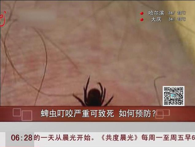 蜱蟲叮咬嚴重可致死如何預防？